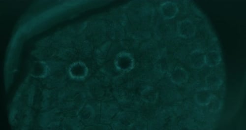 Cancer Cells Under Microscope At Laboratory