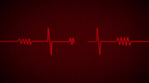 Medical ECG Heartbeat Pulse Monitor Display