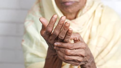 Arthritic Hands of a Senior Adult Massaging Fingers