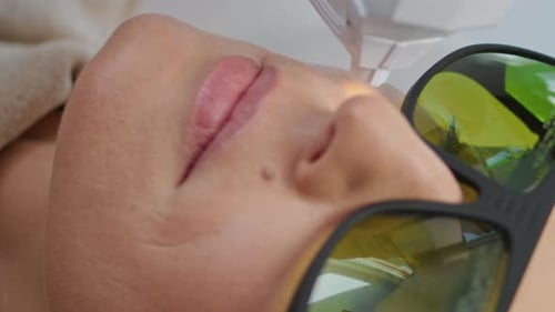 Modern Laser Skincare Procedure Facial Rejuvenation in Salon Vertically Close Up
