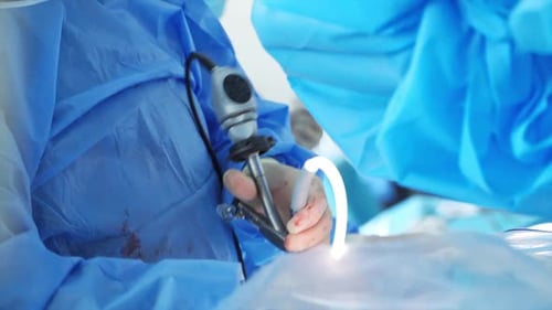 Surgeons Perform Laparoscopic Surgery in Hospital