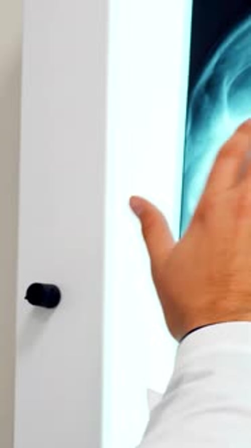 Caucasian Male Hand Carefully Examines Illuminated Xray Images of Head and Chest