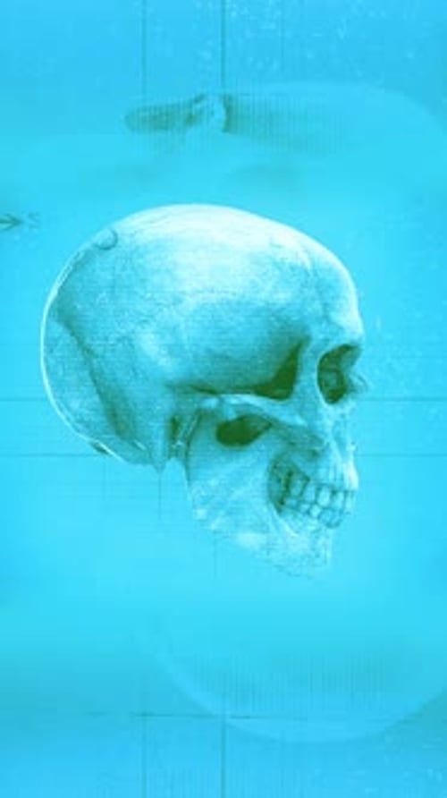 Medical Chart Skull 05