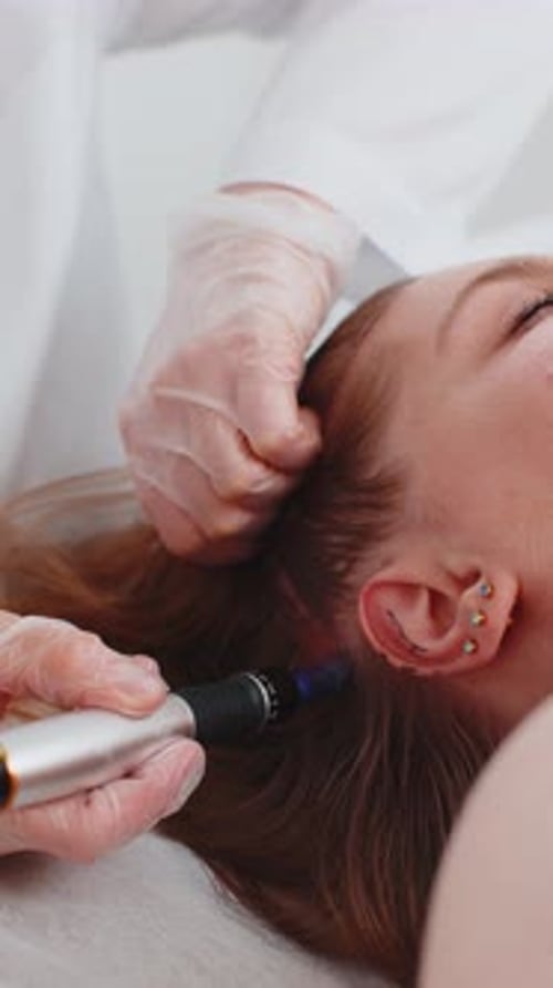 Trichologist Doing Woman Hair Regeneration Procedure Dermapen Microneedling Vitamin Injections
