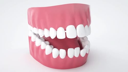 3D Animation of Dental Braces Being Applied