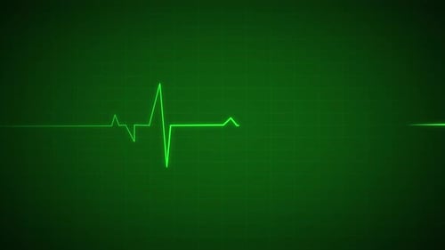 Heart Beat Pulse animated video, medical concept