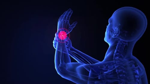 Futuristic X-Ray Scan of Human Wrist Pain Animation
