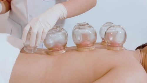 Cupping Therapy on Person's Back in Clinic