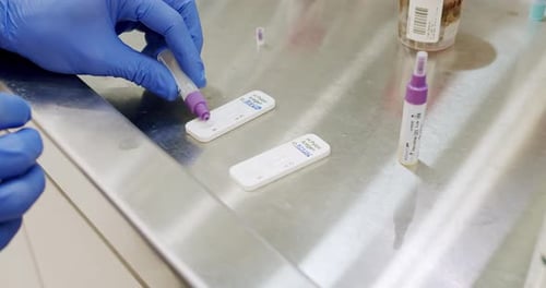Close Up Medical Test in Lab with Gloves