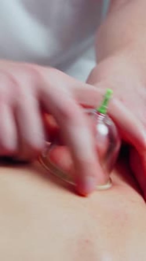 Male Masseur Doing Acupuncture Therapy to Man in Spa Salon Chinese Medicine Modern Massage