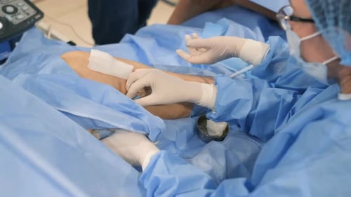 Surgical Operation on the Leg for Varicose Veins A Surgeon Performs an Operation on the Lower Limbs