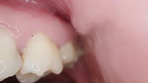 View of Teeth Inside The Mouth Behind The Cheek, Macro Dental Examination.