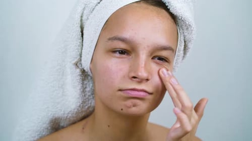 Adolescente triste avec une serviette de bain sur la tête, fronçant les sourcils devant sa peau acnéique