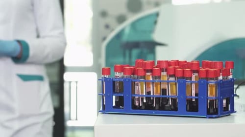 Lab Worker Examines Blood Samples in Test Tubes