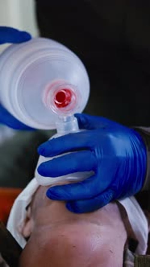 Assisted Ventilation with Bag Valve Mask