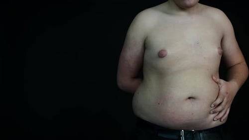 Slow Motion of Overweight Man Shaking His Big Belly Bad Diet and Obesity Concept
