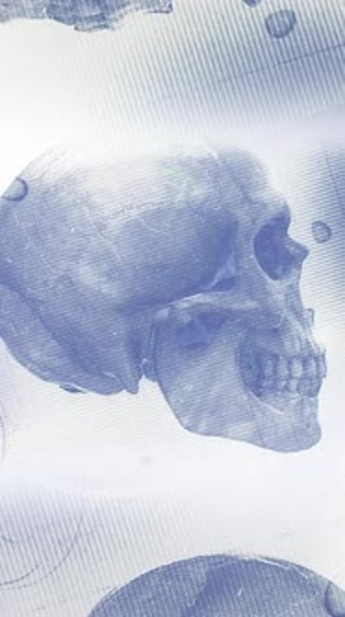 Medical Chart Skull 07