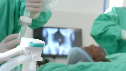 Diverse surgeons giving anesthesia to patient in operating theatre, slow motion