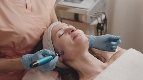 Professional Microneedling Treatment in Skincare Clinic