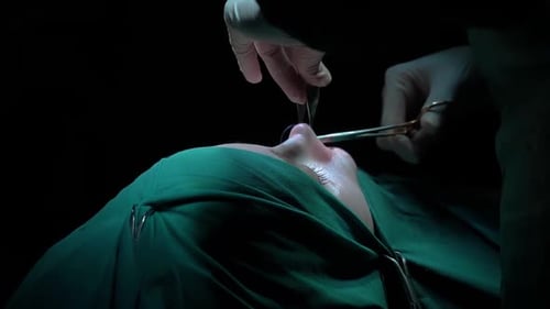 Rhinoplasty procedure and stitching doctor, end of operation.. Rhinoplasty procedure performed by a