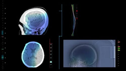 Digitale Datenplatine von Mri Brain Tech