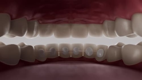 Brackets Inside 003 16х9