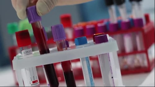 Gloved Hand Placing Blood Sample into Test Tube Rack in Laboratory