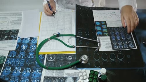 Doctor Examines Brain Scans, Makes Notes