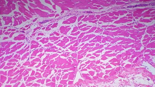 Stratified Squamous Epithelium in Section Filmed By Microscope 200x Against Bright Field