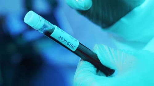 Laboratory Tubes with Blood and Virus Closeup of Scientific Lab in Hospital Epidemic Disease