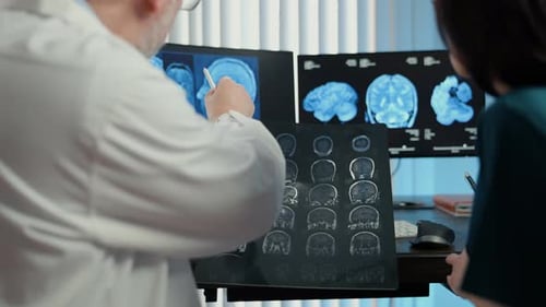 Doctors are Analyzing Brain MRI Scans and Multiple Monitors Stands in Modern Clinic Advanced
