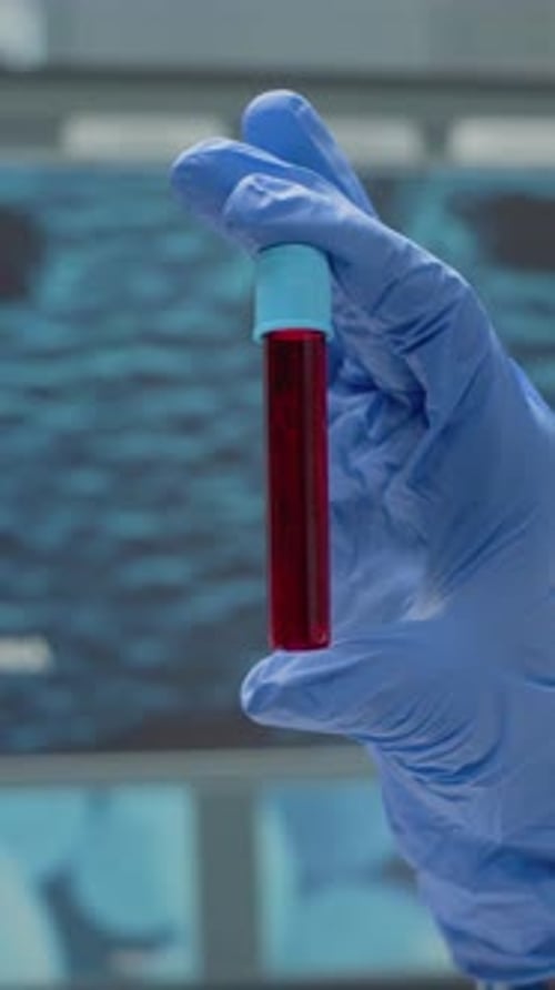 Vertical Video Close Up of Hand with Gloves Holding Vacutainer