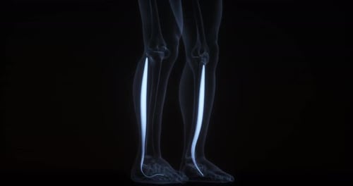 Musculus fibularis longus im menschlichen Körper. Röntgenbild. Schleife