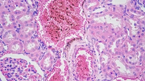 Section of Artery and Vein Under Microscope with 400 Times Magnification Filmed on Bright Field