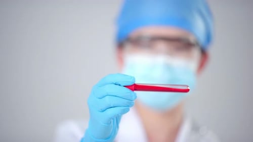 Medical Professional Holds Blood Sample Vial for Testing