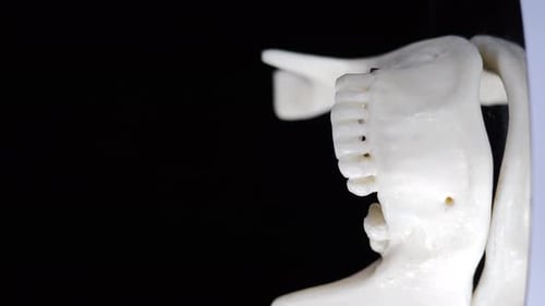 Rotierendes Kiefermodell menschlicher Zähne mit Implantaten und Platzhalterstiften Vertikales Filmmaterial Schwarz