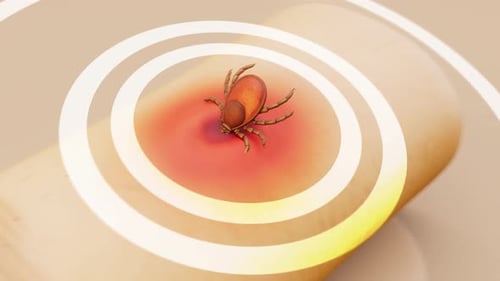 Conceptual 3D animation of the removal of a tick from human skin
