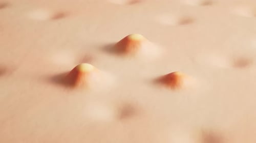 Animated 3D Close-Up of Skin Bumps Formation