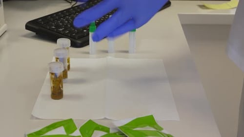 Laboratory technician preparing human stool samples for analysis on blood in feces in small medical