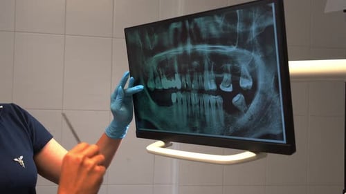 Dentist Hand Explore Study Teeth Mouth Cavity Xray on Monitor Describe Therapy to Patient at