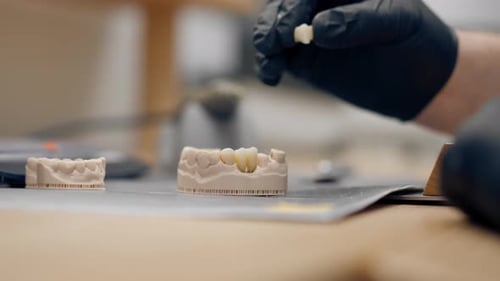 Close Up Professional Laboratory for the Production of Dental Protoses Veneers and Crowns a