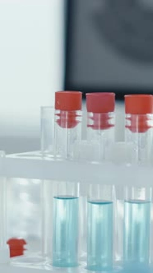 Gloved Hand Places Test Tubes in Rack