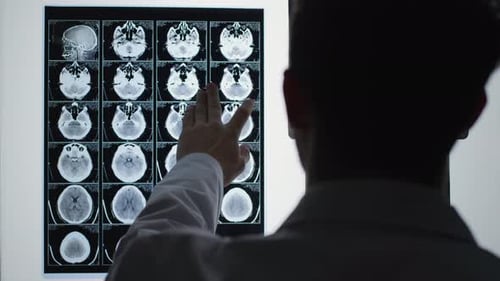 Radiologe analysiert Gehirnscans