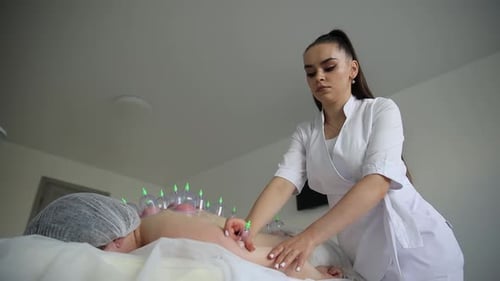 Vacuum Massage Vacuum Cups of Medical Cupping Therapy on Woman Back Close Up Chinese Medicine