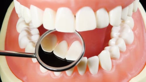 Patient at a Dentist Appointment in a Dental Clinic. View to Inside the Dental Jaw. Tooth Model