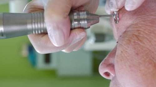 Medical Professional Performing Procedure on Adult's Face