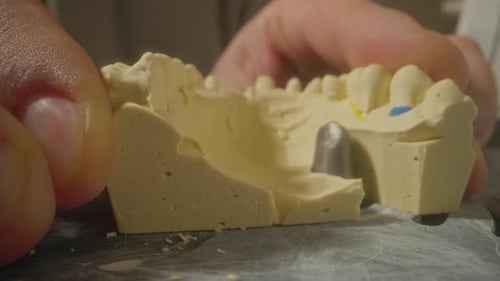 Dental Mold Close-up for Implants and Restorations