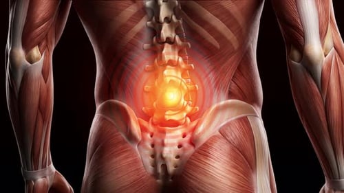 Human figure with back pain highlighted Medical 3D Animation with Pain