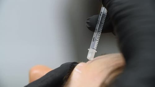 Botox injection by a beautician with a syringe into a woman's forehead. Close up.