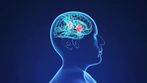 Medical Brain Scan with Interacting Particles